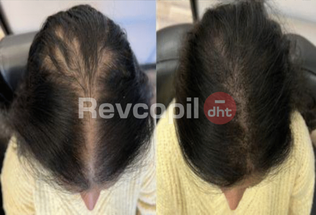 revcapil, revcapil dht cliente 11