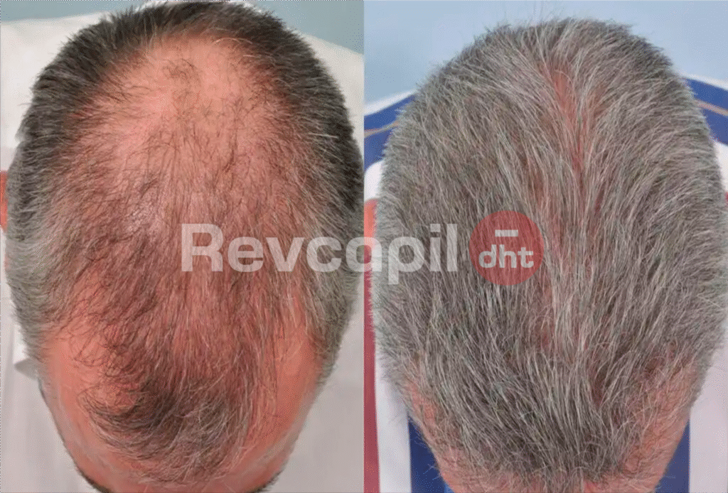 revcapil, revcapil dht cliente 2