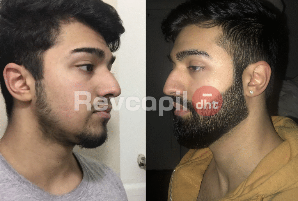 revcapil, revcapil dht cliente 3