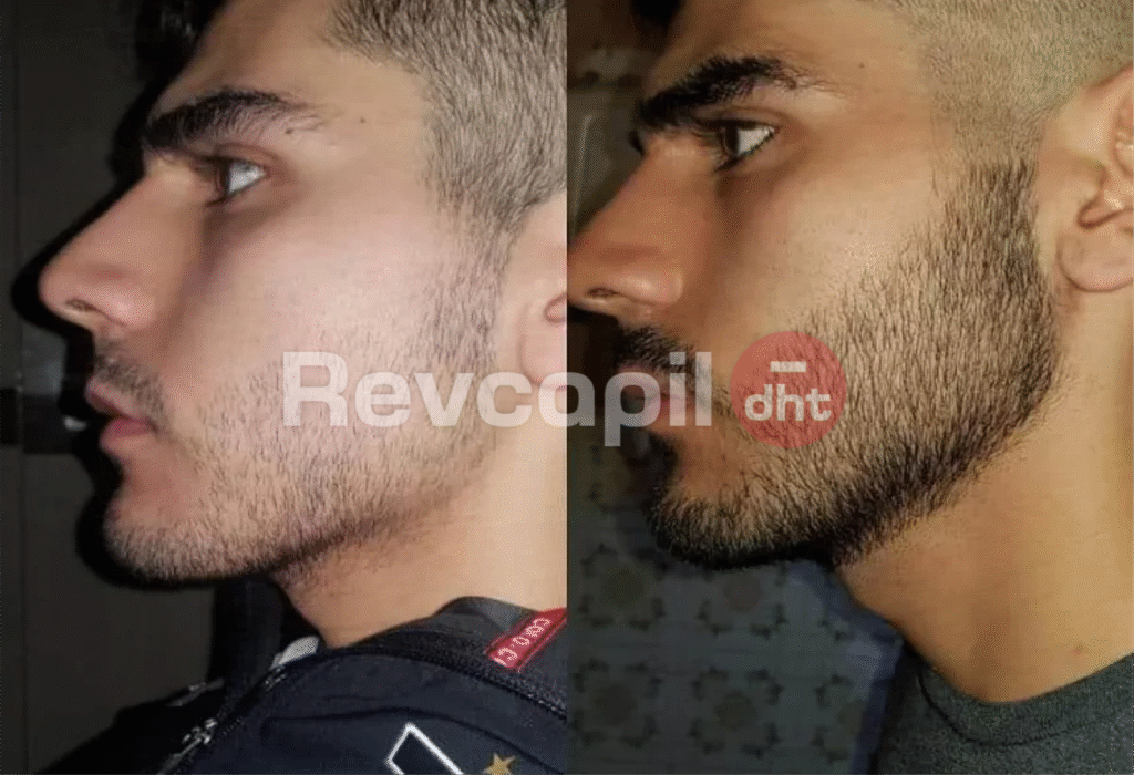 revcapil, revcapil dht cliente 5