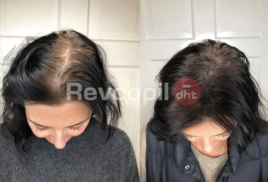 revcapil, revcapil dht cliente 7