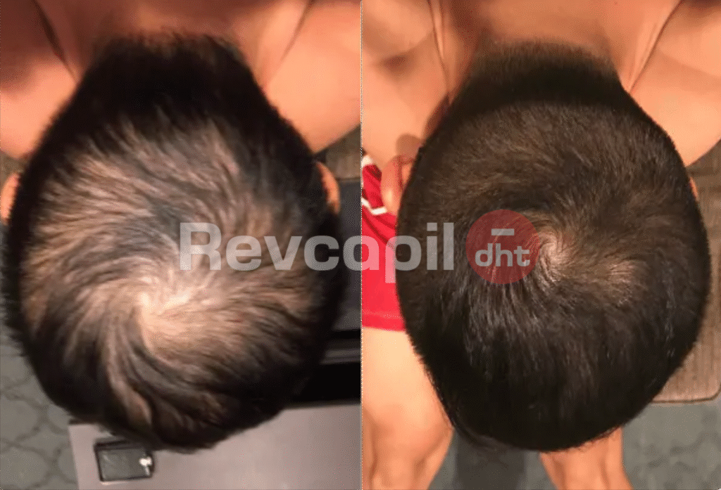 revcapil, revcapil dht cliente 8