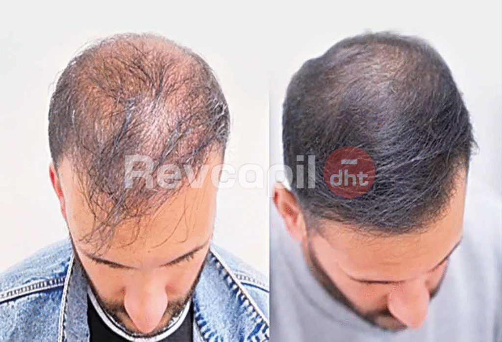 revcapil, revcapil dht cliente 9